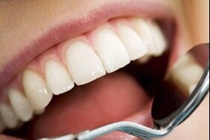 پوسیدگیهای دندانی و افت عملکرد مغز و قلب / ارتباط بیماریهای دهان با بروز برخی سرطانها
