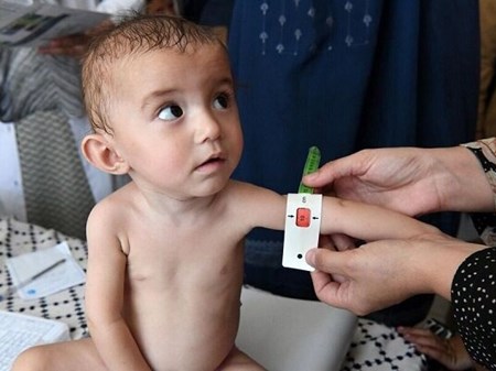گزارش یونیسف: کودکان در سراسر جنوب آسیا با بحران تغذیه روبرو هستند