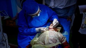 ایجاد بانک سلولهای بنیادی دندان شیری دارای عصب سالم
